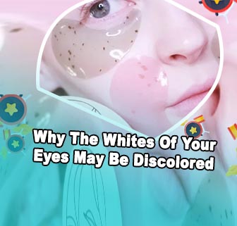 Grey patches in eyes